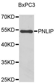 Western blot - PNLIP Polyclonal Antibody (144-07421)