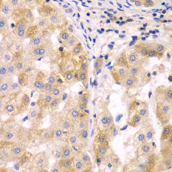 Immunohistochemistry - SULT2B1 antibody (144-07736)