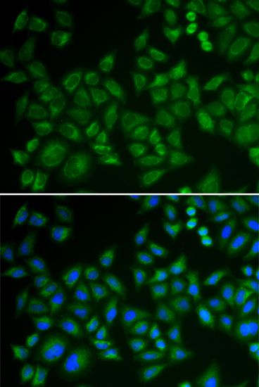 Immunofluorescence - SMPD1 antibody (144-06743)
