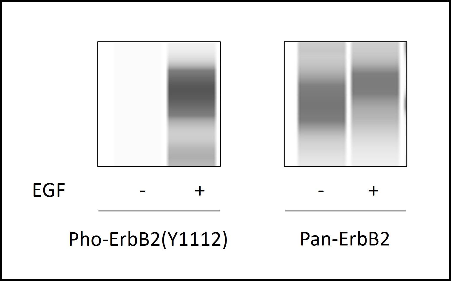 ErbB2-Y1112 Western Blot