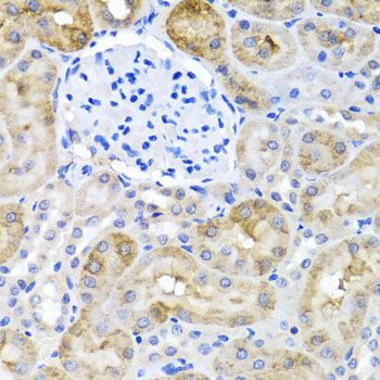Immunohistochemistry - SULT1A1 antibody (144-01599)