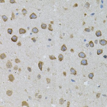 Immunohistochemistry - ASAH2 antibody (144-07985)