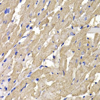 Immunohistochemistry - MPI Polyclonal Antibody (144-07319)