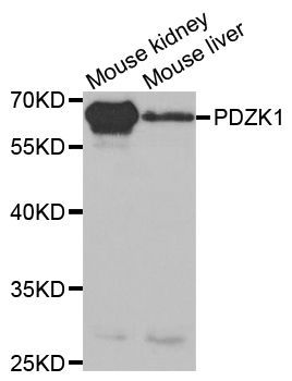 Western blot - PDZK1 antibody (144-05321)