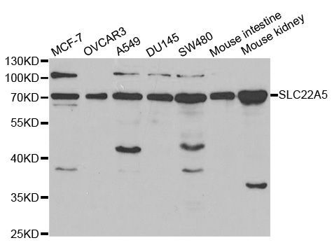 Western blot - SLC22A5 Polyclonal Antibody (144-01676)