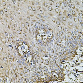 Immunohistochemistry - CPOX antibody (144-03807)