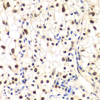 Immunohistochemistry - NFKBIB antibody (144-05777)