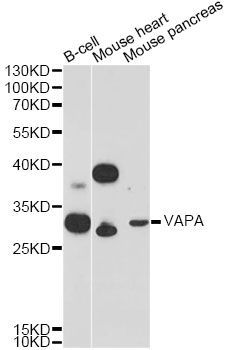 Western blot - VAPA Antibody (144-12939)