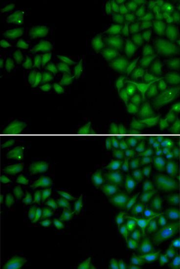 Immunofluorescence - NEFL Polyclonal Antibody (144-00257)