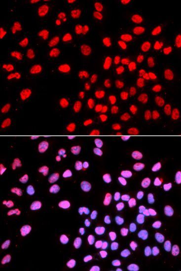 Immunofluorescence - IKZF1 Polyclonal Antibody (144-01850)