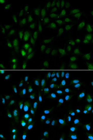 Immunofluorescence - TFPI antibody (144-01624)