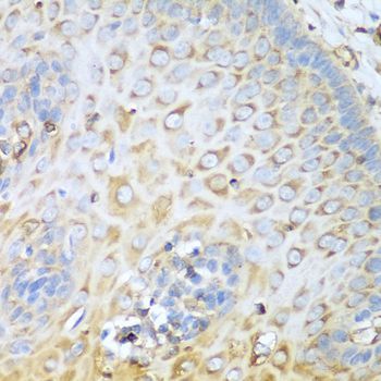 Immunohistochemistry - MYH9 Polyclonal Antibody (144-00173)