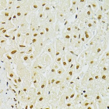 Immunohistochemistry - ADAR Polyclonal Antibody (144-07869)
