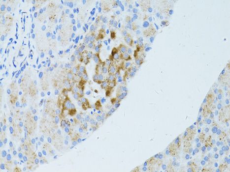 Immunohistochemistry - OCLN antibody (144-02601)