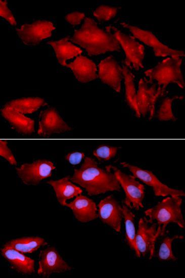 Immunofluorescence - CTNND1 antibody (144-01641)