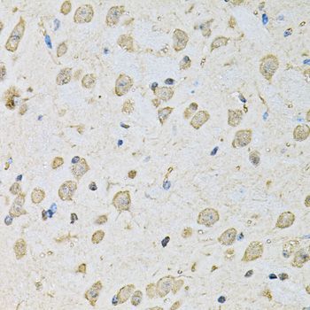 Immunohistochemistry - PSMC2 Polyclonal Antibody (144-01985)