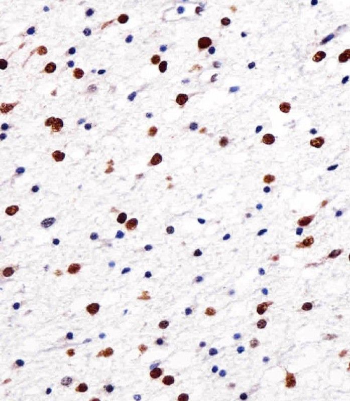 IHC-P