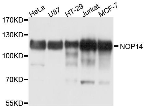Western blot - NOP14 Polyclonal Antibody (144-10361)