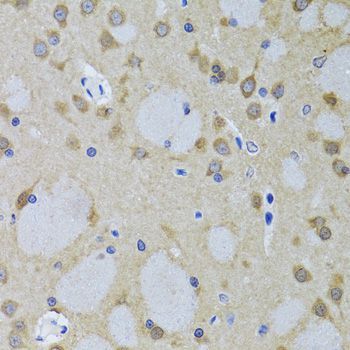 Immunohistochemistry - YWHAZ Polyclonal Antibody (144-07639)