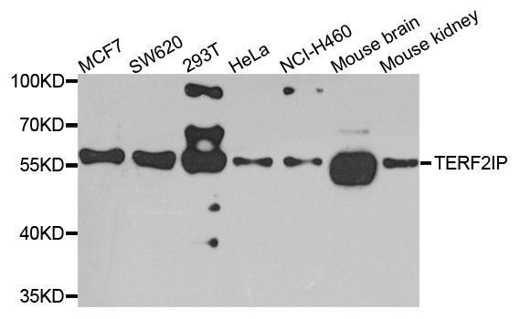 Western blot - TERF2IP Polyclonal Antibody (144-07981)