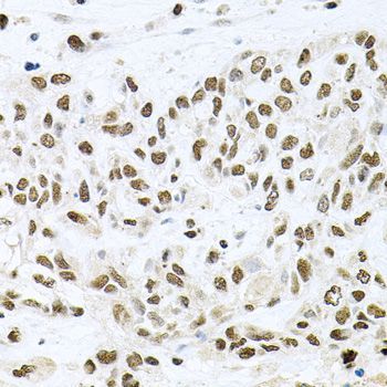Immunohistochemistry - BCCIP Polyclonal Antibody (144-08586)