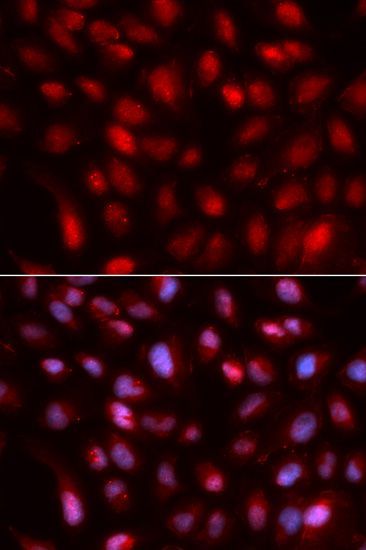 Immunofluorescence - SUMO2 antibody (144-02571)