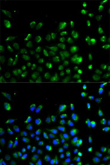 Immunofluorescence - ATG13 Polyclonal Antibody (144-00690)