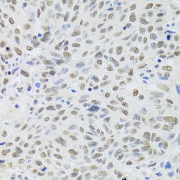 Immunohistochemistry - DDB1 Polyclonal Antibody (144-02896)
