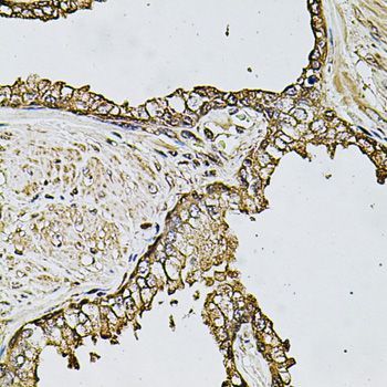 Immunohistochemistry - CSTB Polyclonal Antibody (144-03815)