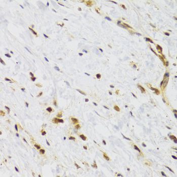 Immunohistochemistry - RAD50 Polyclonal Antibody (144-60013)