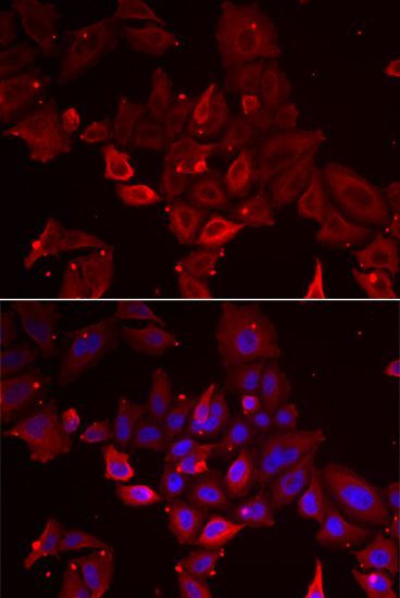 Immunofluorescence - MYOT antibody (144-06439)