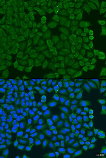 Immunofluorescence - KCTD15 antibody (144-08256)