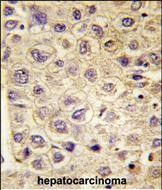 IHC-P
