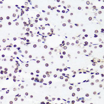 Immunohistochemistry - TriMethyl-Histone H3-K36 pAb (144-02366)