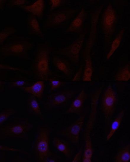 Immunofluorescence - [KO Validated] YAP1 Polyclonal Antibody (144-01002)