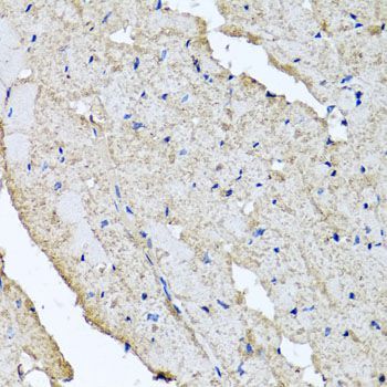 Immunohistochemistry - USH1C antibody (144-04368)