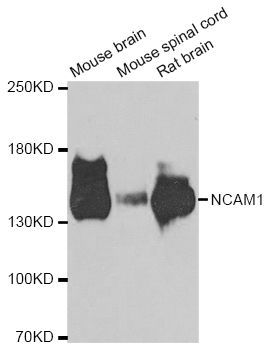 Western blot - NCAM1 antibody (144-07913)