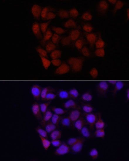 Immunohistochemistry - [KO Validated] YAP1 Polyclonal Antibody (144-01002)