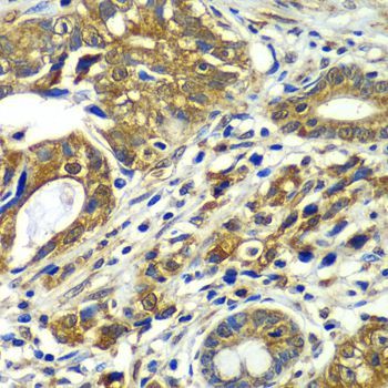 Immunohistochemistry - CDC16 antibody (144-07197)