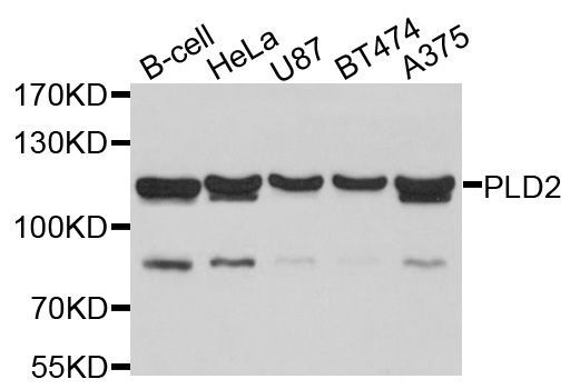 Western blot - PLD2 Polyclonal Antibody (144-10192)