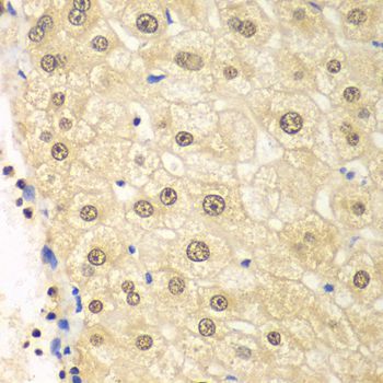 Immunohistochemistry - PSMD2 antibody (144-01999)
