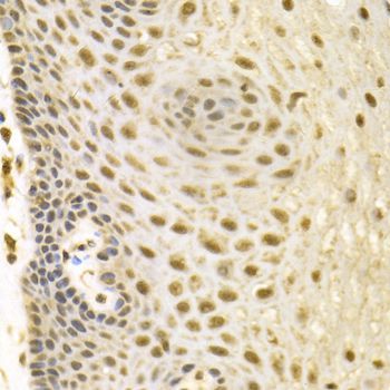 Immunohistochemistry - BAG1 Antibody (144-01104)