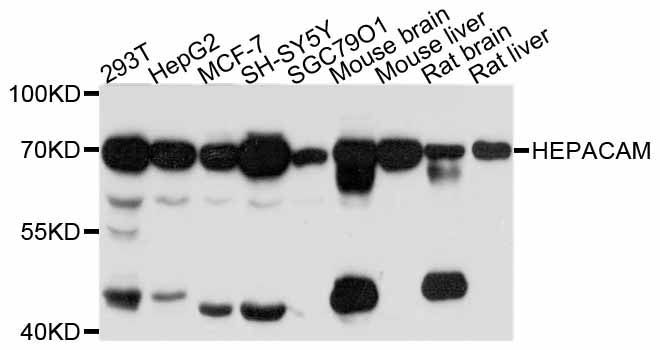 Western blot - HEPACAM antibody (144-11589)