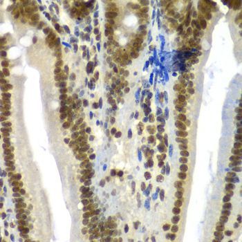 Immunohistochemistry - SF3B2 Polyclonal Antibody (144-05875)