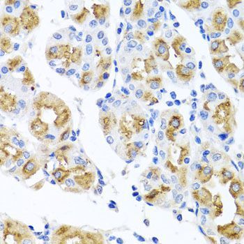 Immunohistochemistry - FECH antibody (144-08418)
