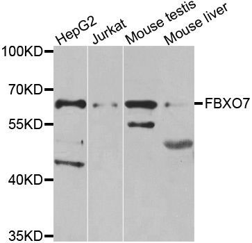 Western blot - FBXO7 Polyclonal Antibody (144-07464)