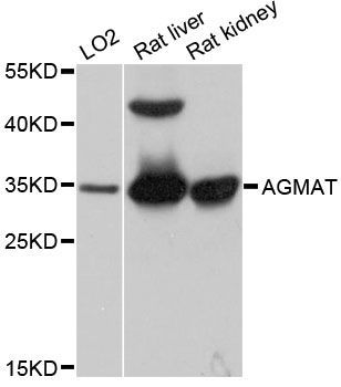 Western blot - AGMAT antibody (144-012192)