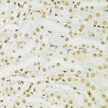 Immunohistochemistry - ADAR Polyclonal Antibody (144-07869)