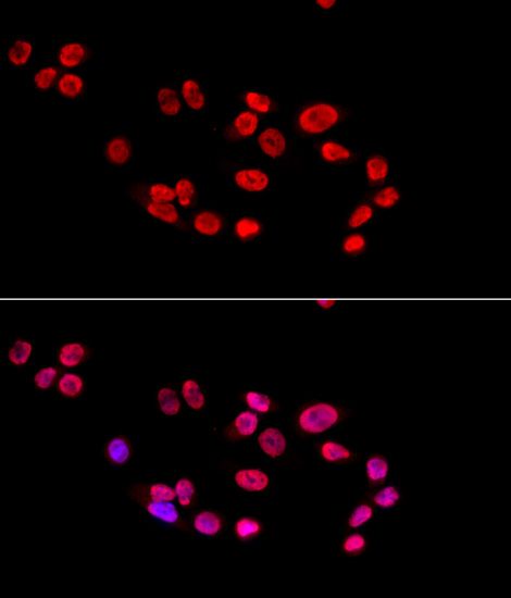 Immunofluorescence - XRCC5 antibody (144-05862)