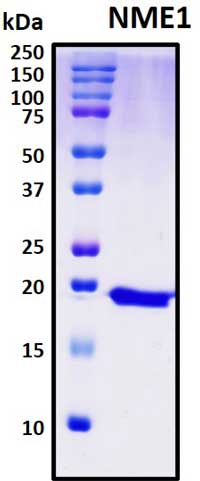 SDS-PAGE